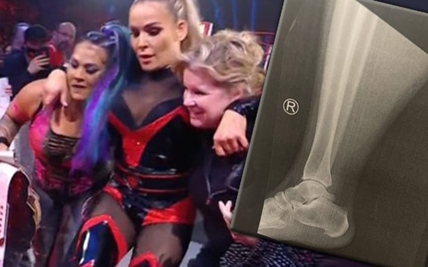 WWE Superstar Natalya posts X-Ray of her ankle injury